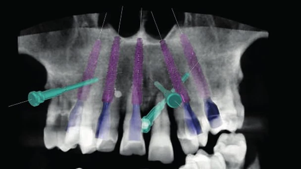 Figure 05 from the published case