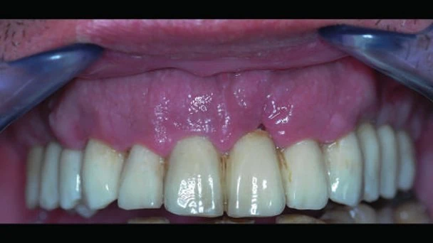 Figure 23 from the published case