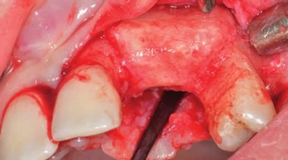 Figure 16 from the published case