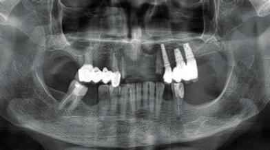 Figure 02 from the published case