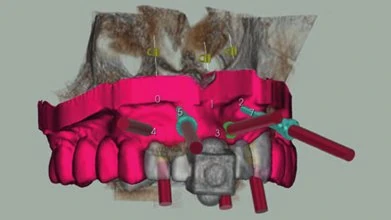 Figure 12 from the published case