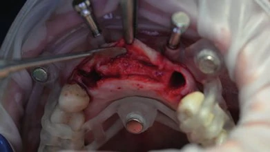 Figure 26 from the published case