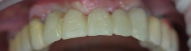 Figure 41 from the published case