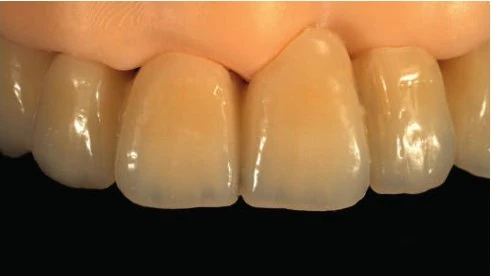 Figure 18 from the published case